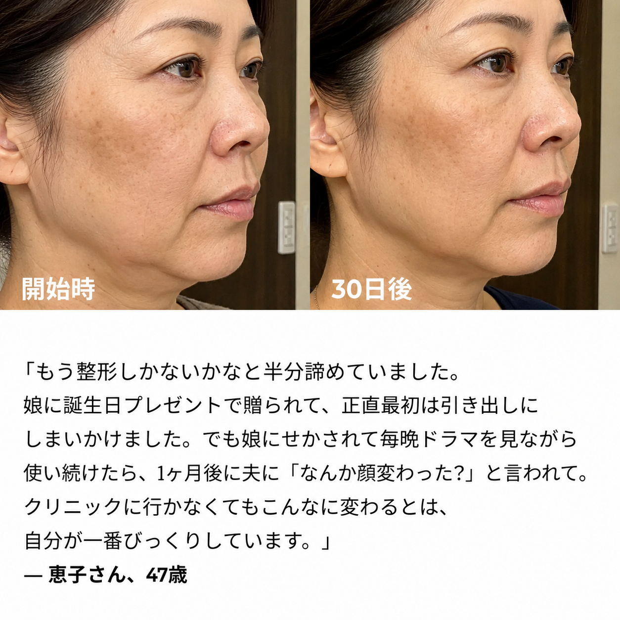 艶肌 じんわりVリフト美顔器