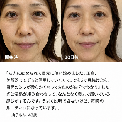 艶肌 じんわりVリフト美顔器